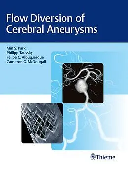 E-Book (epub) Flow Diversion of Cerebral Aneurysms von Min S. Park, Phil Taussky, Felipe C. Albuquerque