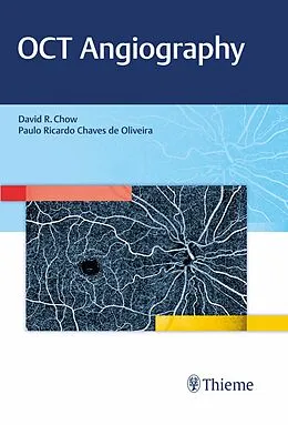 E-Book (epub) OCT Angiography von David Chow