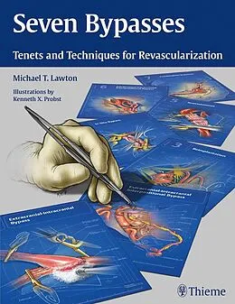E-Book (epub) Seven Bypasses von Michael T. Lawton