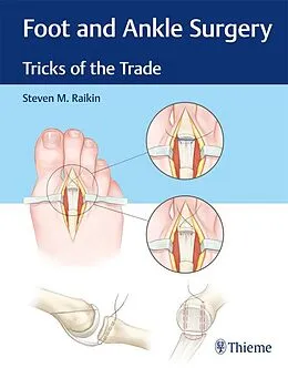 E-Book (epub) Foot and Ankle Surgery von Steven M. Raikin