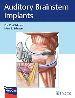 E-Book (epub) Auditory Brainstem Implants von Eric P. Wilkinson, Marc S. Schwartz