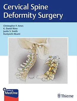 E-Book (epub) Cervical Spine Deformity Surgery von Christopher P. Ames, K. Daniel Riew, Justin S. Smith