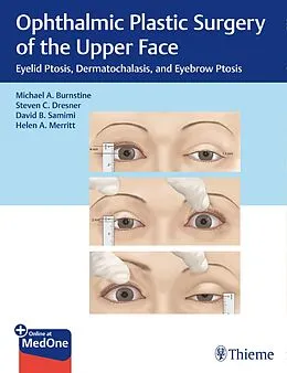 E-Book (epub) Ophthalmic Plastic Surgery of the Upper Face von Michael A. Burnstine, Steven C. Dresner, David B. Samimi