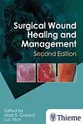 ePUB Surgical Wound Healing and Management von 