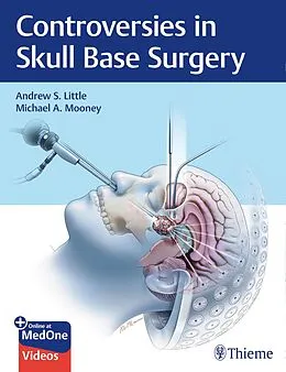 E-Book (epub) Controversies in Skull Base Surgery von Andrew S. Little, Michael A. Mooney