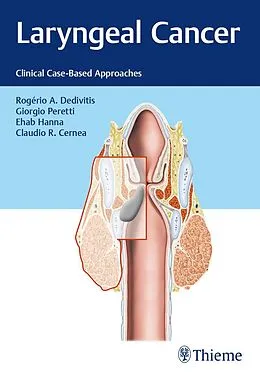 E-Book (epub) Laryngeal Cancer von Rogério A. Dedivitis, Giorgio Peretti, Ehab Y. Hanna