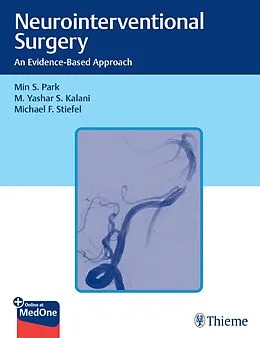 E-Book (epub) Neurointerventional Surgery von Min S. Park, M. Yashar Kalani, Michael Stiefel