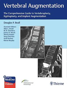 E-Book (epub) Vertebral Augmentation von Douglas P. Beall