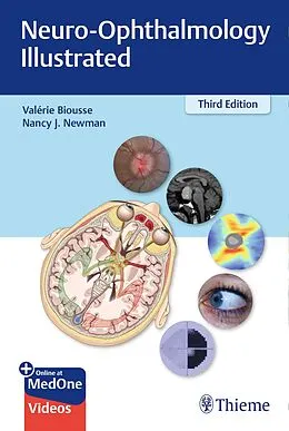 E-Book (epub) Neuro-Ophthalmology Illustrated von Valerie Biousse, Nancy Newman