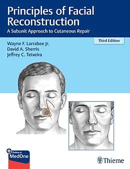 E-Book (epub) Principles of Facial Reconstruction von Wayne F. Larrabee, David A. Sherris, Jeffrey Teixeira