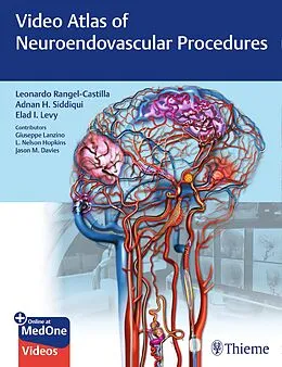 E-Book (epub) Video Atlas of Neuroendovascular Procedures von Leonardo Rangel-Castilla, Adnan H. Siddiqui, Elad I. Levy