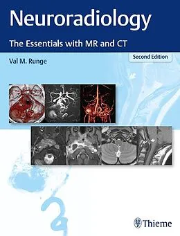 E-Book (epub) Neuroradiology von Val M. Runge