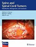 E-Book (epub) Spine and Spinal Cord Tumors von Andrew Fanous, Michael Wang, Allan Levi