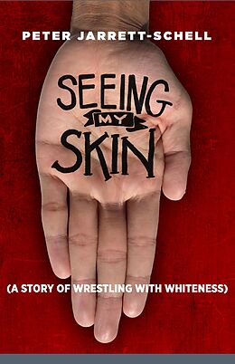 eBook (epub) Seeing My Skin de Peter Jarrett-Schell