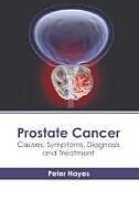 Livre Relié Prostate Cancer: Causes, Symptoms, Diagnosis and Treatment de 