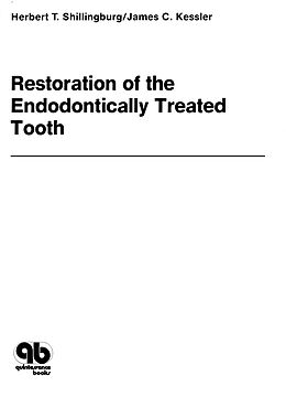 eBook (pdf) Restoration of the Endodontically Treated Tooth de Herbert T. Shillingburg Jr., James C. Kessler