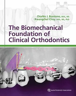 eBook (pdf) The Biomechanical Foundation of Clinical Orthodontics de Charles J. Burstone, Kwangchul Choy
