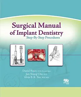 E-Book (pdf) Surgical Manual of Implant Dentistry von Daniel Buser, Jun-Young Cho, Alvin B. Yeo