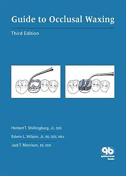E-Book (pdf) Guide to Occlusal Waxing von Herbert T. Shillingburg Jr, Edwin L. Wilson Jr, Jack T. Morrison