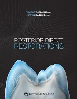 E-Book (pdf) Posterior Direct Restorations von Salvatore Scolavino, Gaetano Paolone