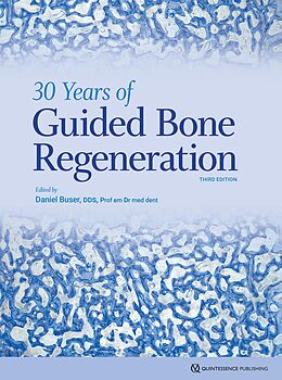 E-Book (pdf) 30 Years of Guided Bone Regeneration von Daniel Buser