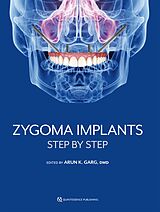 eBook (epub) Zygoma Implants de Arun K. Garg