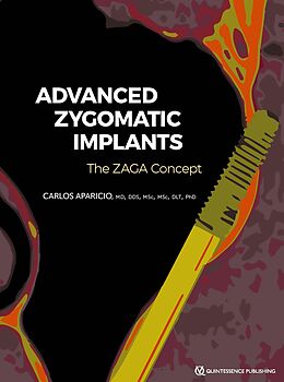 eBook (epub) Advanced Zygomatic Implants de Carlos Aparicio