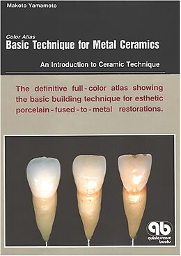 eBook (epub) Color Atlas Basic Technique for Metal Ceramics de Makoto Yamamoto