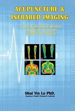 E-Book (epub) Acupuncture and Infrared Imaging von Shui Yin Lo