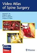 E-Book (pdf) Video Atlas of Spine Surgery von Howard S. An, Philip K. Louie, Bryce A. Basques