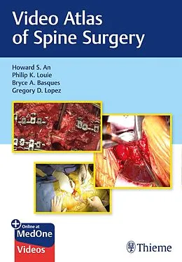 E-Book (pdf) Video Atlas of Spine Surgery von Howard S. An, Philip K. Louie, Bryce A. Basques