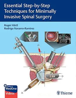 E-Book (pdf) Essential Step-by-Step Techniques for Minimally Invasive Spinal Surgery von Roger Hartl, Rodrigo Navarro-Ramirez