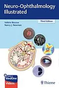 E-Book (pdf) Neuro-Ophthalmology Illustrated von Valerie Biousse, Nancy J. Newman