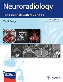 E-Book (pdf) Neuroradiology von Val M. Runge