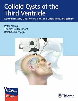 E-Book (pdf) Colloid Cysts of the Third Ventricle von Peter Nakaji, Thomas Beaumont, Jr. Dacey
