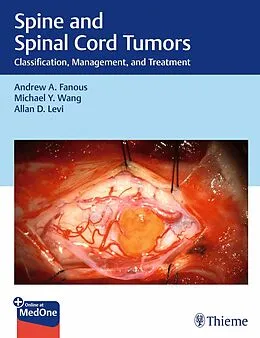 E-Book (pdf) Spine and Spinal Cord Tumors von Andrew Fanous, Michael Wang, Allan Levi