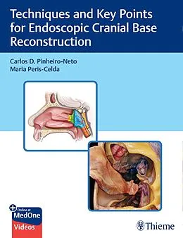 E-Book (pdf) Techniques and Key Points for Endoscopic Cranial Base Reconstruction von Carlos Pinheiro-Neto, Maria Peris-Celda