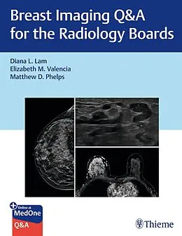 E-Book (pdf) Breast Imaging Q&A for the Radiology Boards von Diana Lam, Elizabeth Valencia, Matthew Phelps