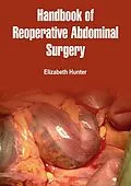 E-Book (epub) Handbook of Reoperative Abdominal Surgery von Elizabeth Hunter