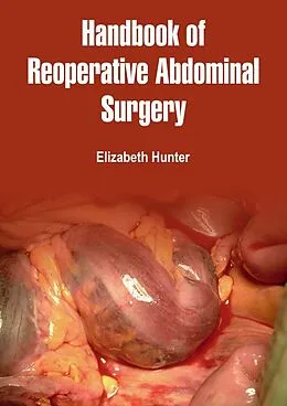 E-Book (epub) Handbook of Reoperative Abdominal Surgery von Elizabeth Hunter