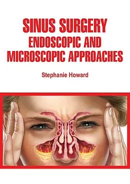 E-Book (epub) Sinus Surgery von Stephanie Howard
