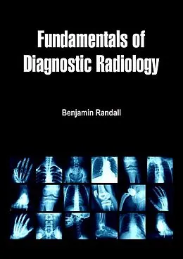 E-Book (epub) Fundamentals of Diagnostic Radiology von Benjamin Randall