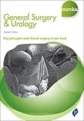 E-Book (epub) Eureka: General Surgery & Urology von Stephen Parker