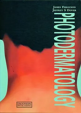 E-Book (pdf) Photodermatology von James Ferguson, Jeffrey Dover