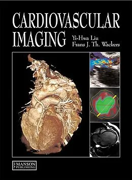 E-Book (pdf) Cardiovascular Imaging von Yi-Hwa Liu, Frans Wackers