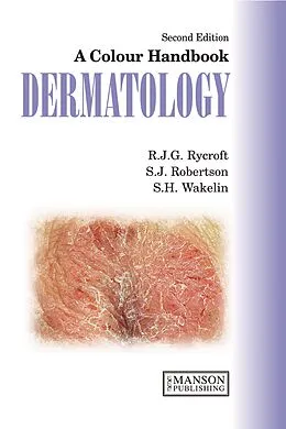 E-Book (pdf) Dermatology von Richard Rycroft, Stuart Robertson, Sarah Wakelin