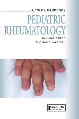 E-Book (pdf) Pediatric Rheumatology von Anne Marie Reed, Thomas Mason