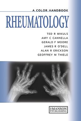 eBook (pdf) Rheumatology de Ted Mikuls, Amy Cannella, Gerald Moore