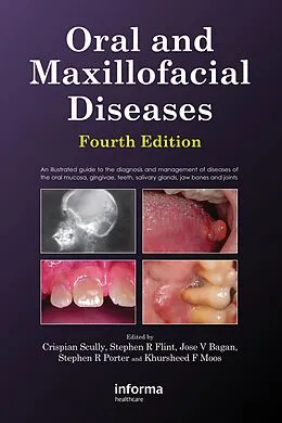 E-Book (pdf) Oral and Maxillofacial Diseases, Fourth Edition von Crispian Scully, Stephen Flint