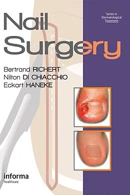 E-Book (pdf) Nail Surgery von Bertrand Richert, Nilton Di Chiacchio, Eckart Haneke
